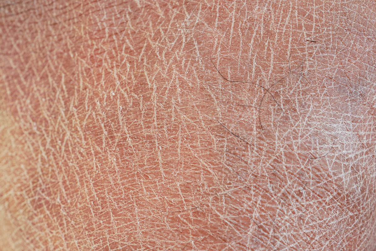 The Surprising Link Between Hard Water and Dry Skin (And How to Fix It).